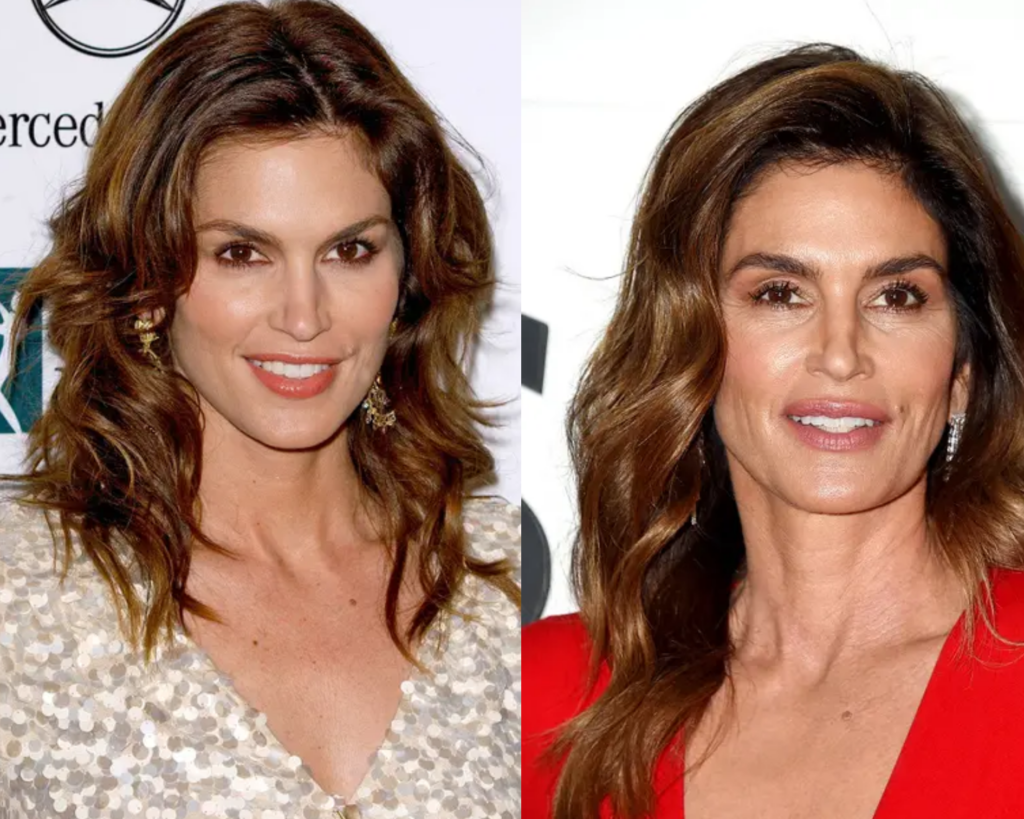 Cindy-Crawford-chirurgie-esthétique-1