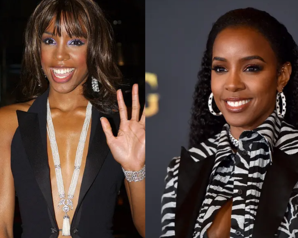 Kelly-Rowland-chirurgie-esthétique