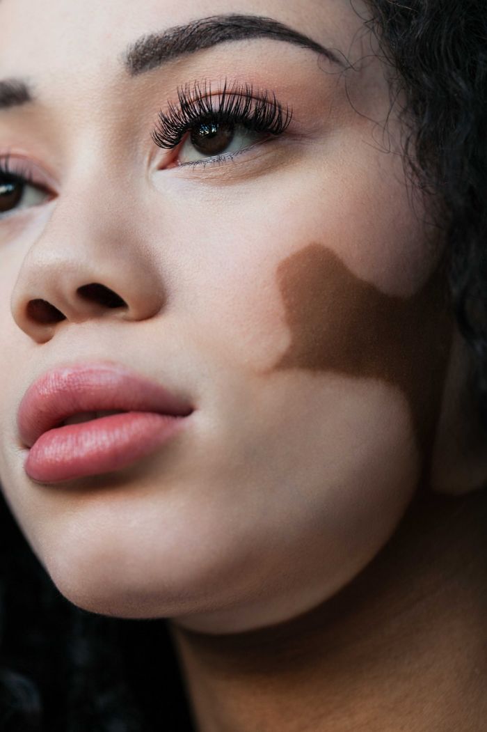 vitiligo beauty photography elisabeth van aalderen 27 5dd3a0699a000 700 vitiligo