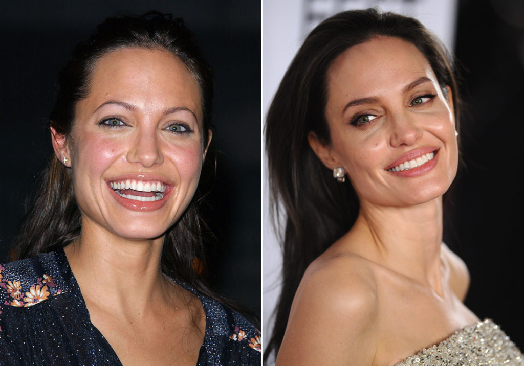 Les sourcils d Angelina Jolie avant apres stars chirurgie esthétique