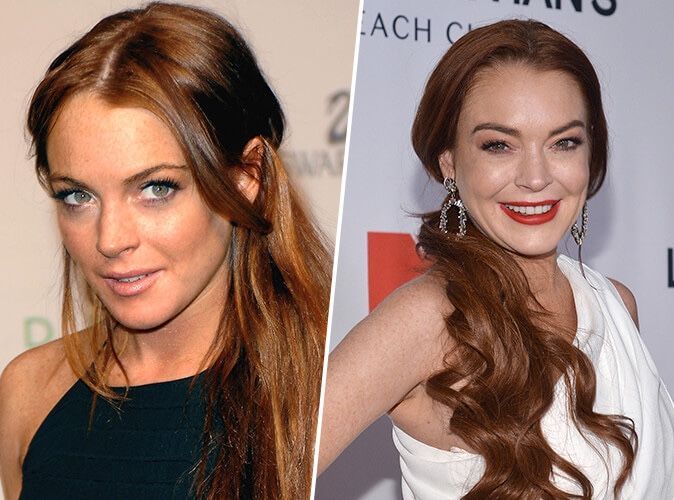 Lindsay Lohan metamorphosee elle fete ses 33 ans en posant nue stars chirurgie esthétique