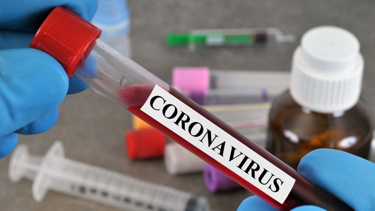 dépistage du coronavirus